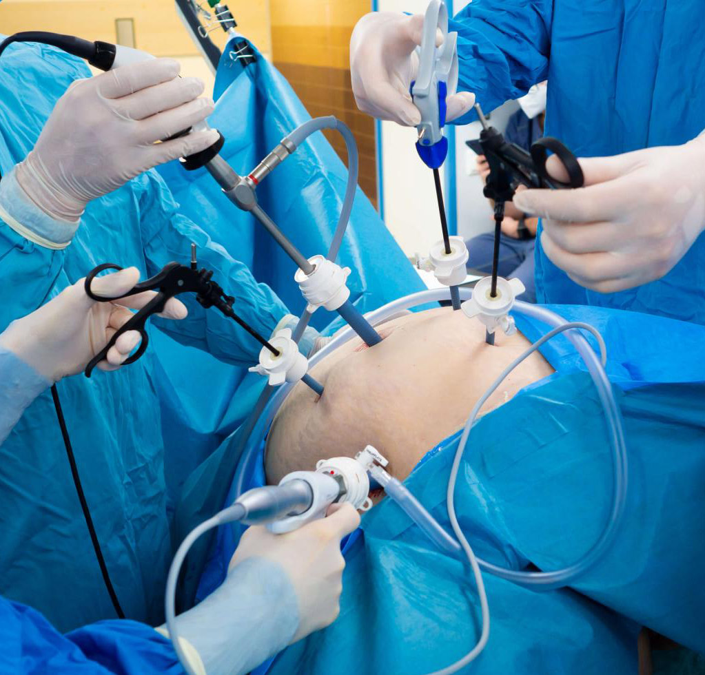 Preparo Bioimpedância