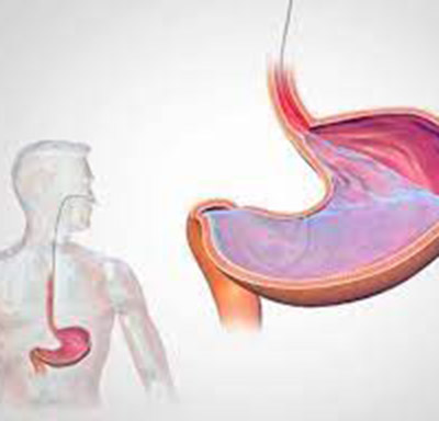 Preparo PH Metria e Manometria Esofágica